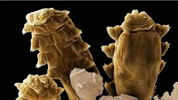 Come eliminare il demodex?