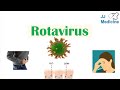 Rotavirus | Risk Factors, Pathophysiology, Symptoms, Diagnosis, Treatment