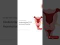 Irregular Periods? This Might Be PCOS ⚠️