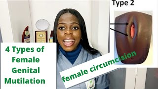 4 Types Of Female Genital Mutilation You Should Know