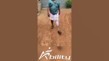 BK prosthesis with plastic check socket / after 1 week training . #prosthesis #prosthetics