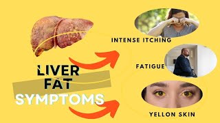Fatigue, Nausea, Yellow Skin: Could It Be Fatty Liver?