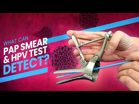 Pap Smear (Pap Test) and HPV Test - A step by step guide (3D) at what happens during the test