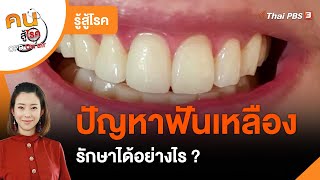 ปัญหาฟันเหลือง : รู้สู้โรค