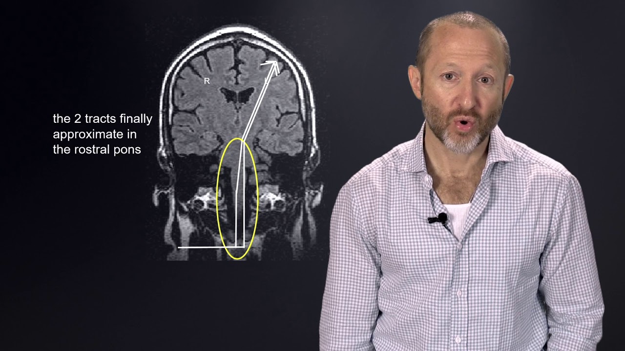Localization and Differential Diagnosis for Tropical Neurology hq