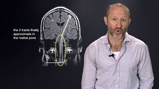 Localization and Differential Diagnosis for Tropical Neurology hq