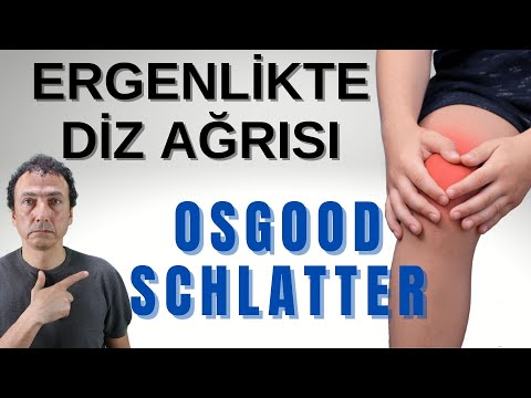 Video: Osgood Schlatter Hastalığı ile Başa Çıkmanın 3 Yolu