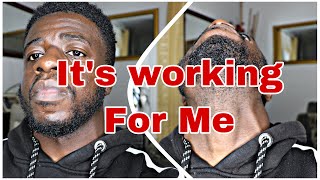 Celebrity My Minoxidil Daily Routine ( This is why it’s working for me ) Wealth