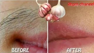 توقفي عن الحلاقة هذه اسهل طريقة لإزالة شعر الوجه والجسم والعانة، سيسقط الشعر لوحده بدون ألم تفتيح