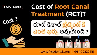 Cost of Root Canal Treatment ( RCT ) | రూట్ కెనాల్ ట్రీట్మెంట్ కి ఎంత ఖర్చు అవుతుంది ? | FMS Dental
