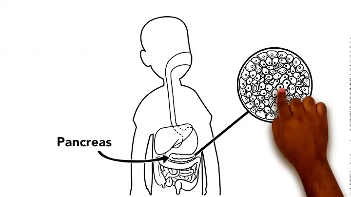 Consecutive interpreting Diabetes education (Eng-Ar)