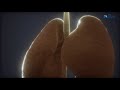 Akciğer Kanserinde Işın Tedavisi
