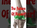 Beyond Transplants#stemcelltreatment #stemcells #heartdisease #cell therapy#neet#shorts #viralvideo
