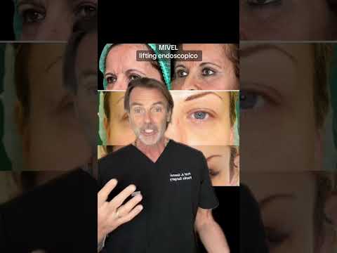 La tecnica MIVEL è adatta per il mio viso?