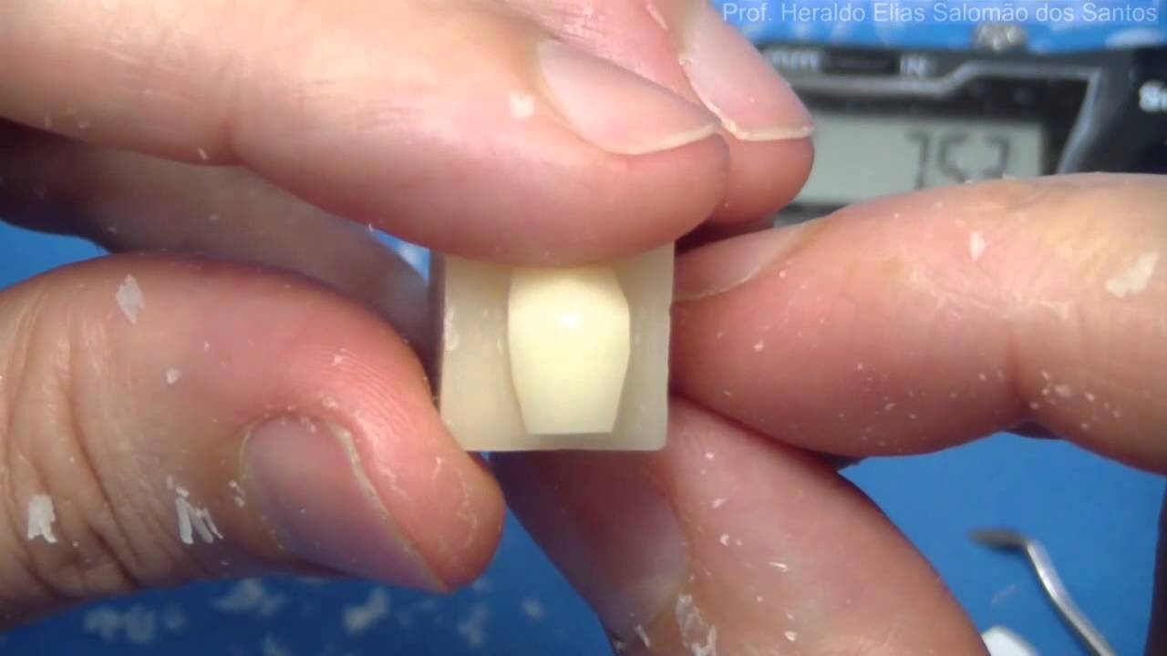 Primeiro Pré-molar Superior