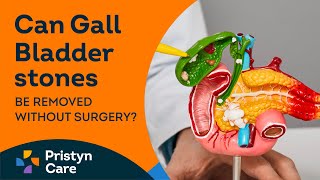 Can Gall Bladder stones be removed without surgery?