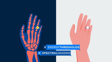 Schweizer Röntgentechnologie der Extraklasse von Dectris