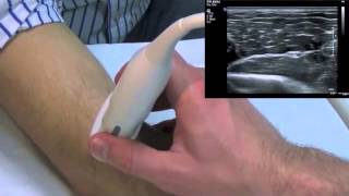 Lateral Elbow US