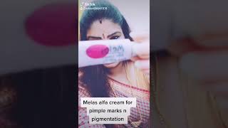 Melas alfa cream for  post pimple marks, hyperpigmentatuon