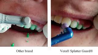 Decrease Splatter with Vera® Splatter Guard®