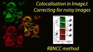 Colocalisation in ImageJ : correcting noisy (poor quality) images