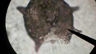 Shelled Amoeba - Extends Pseudopod