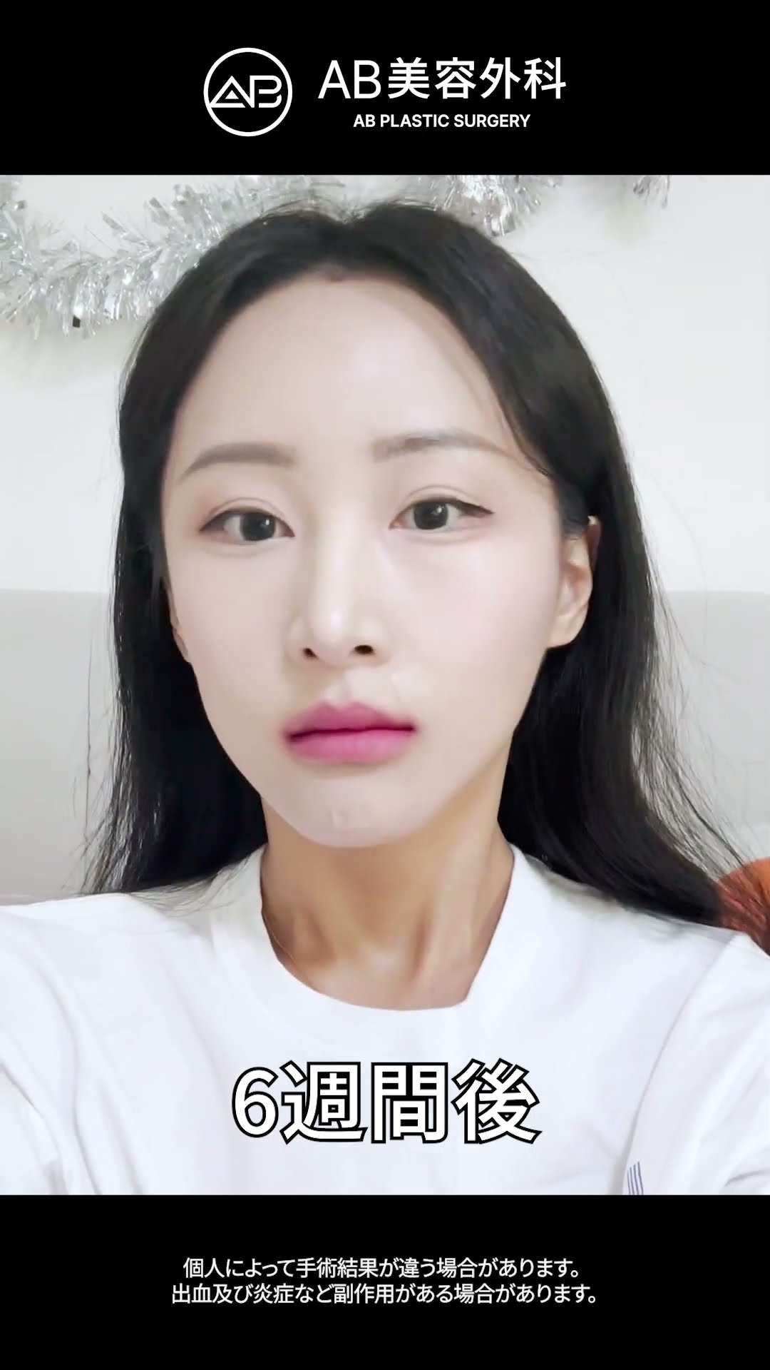 3つの力！究極のフェイシャル輪郭メイクオーバー #shorts #韓国整形 #美容