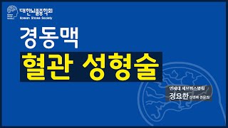 경동맥 혈관 성형술