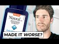 Nizoral shampoo for hair loss  the truth