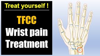 Wrist pain pinky side treatment: TFCC injury pain relief massage and exercises