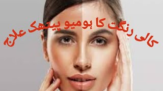 Best Homeopathic medicine for Whitening of face کالی رنگت کا ہومیو پیتھک علاج