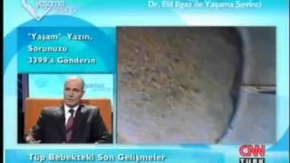 Tüp Bebek Ne Zaman Yapılmalı & Prof Dr Bülent Baysal