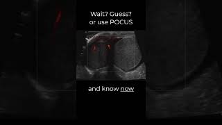 Time is testicle #pocus  #emergencymedicine