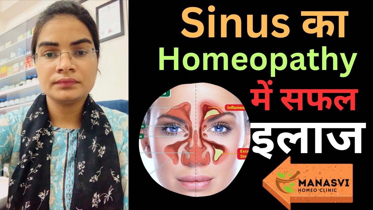 Sinus का Homeopathy में सफल इलाज ॥ Best homeopathic medicine for