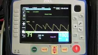 Instruction of the Zoll X Series - Part 2 (NIBP and SpO2/SpCO)