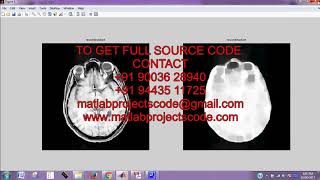 The connected brain matlab projects code