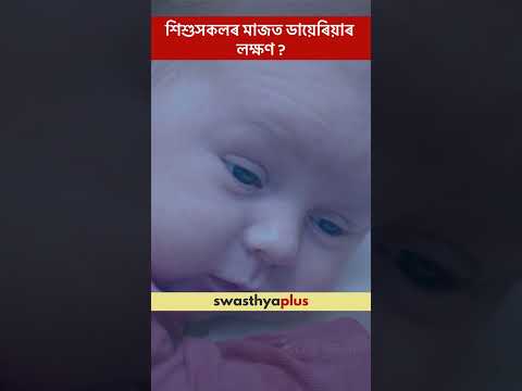 শিশুসকলৰ মাজত ডায়েৰিয়াৰ লক্ষণ? | Symptoms of Diarrhea in Children | Dr Indira Das | #Shorts