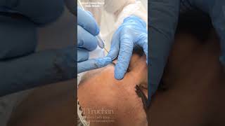 Annual Colour Boost Male Microblading