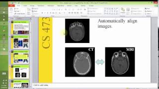 uWaterloo: CS 473 (Medical Image Processing)