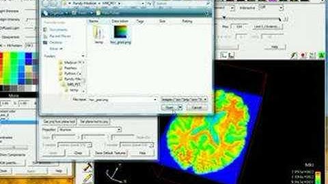 EnSight Medical Imaging Tutorial 1