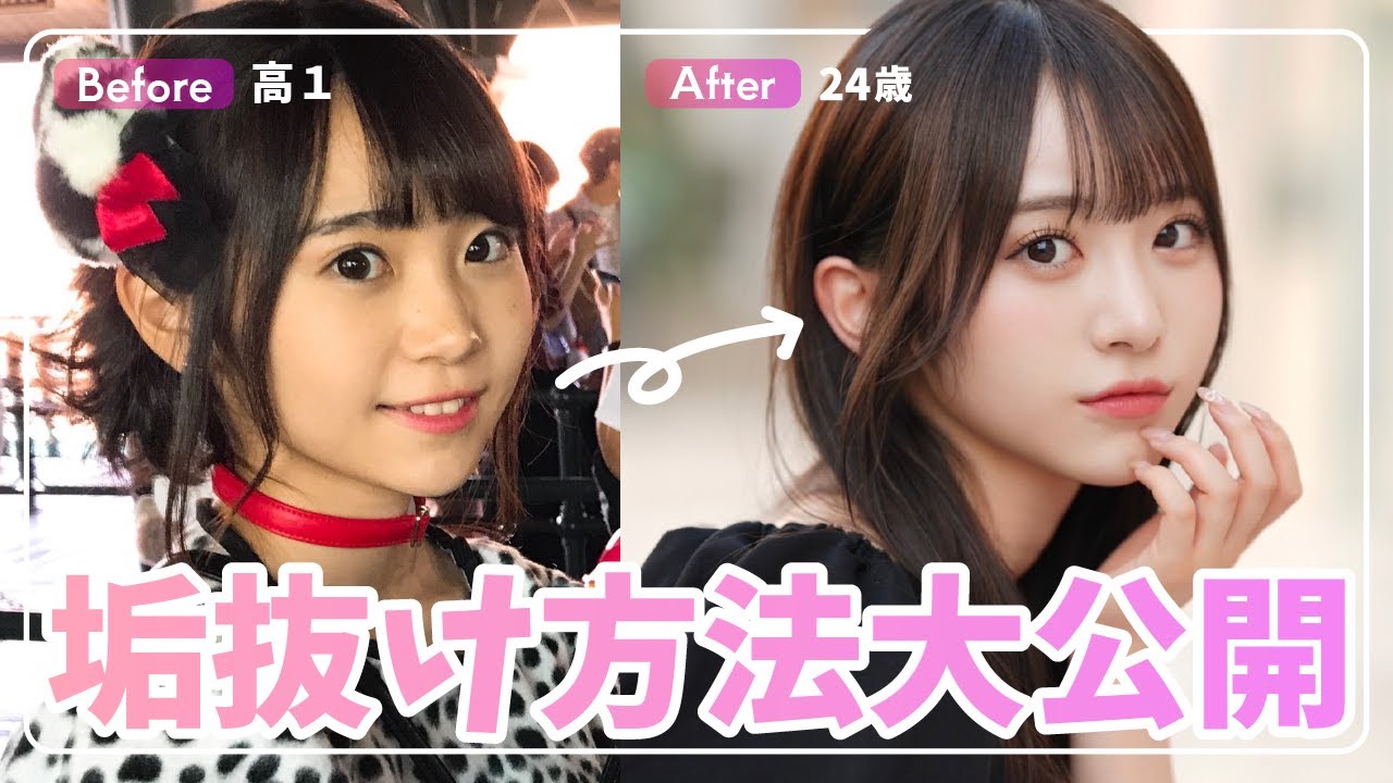 【激変】実はコソコソ美容施術やってたので紹介します