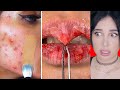 LAS TRANSFORMACIONES DE BELLEZA MAS EXTREMAS | Mariale