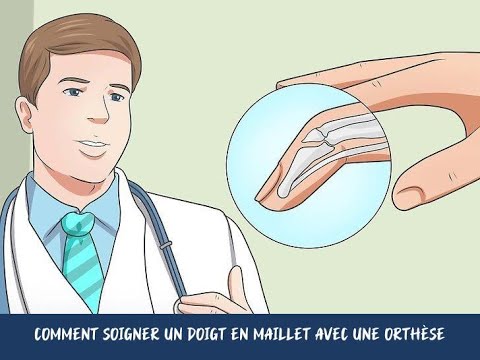 Vidéo: Quel est le doigt de maillet ?