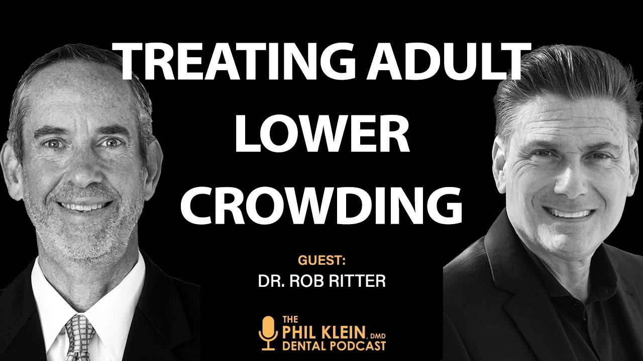 Лечение с помощью прозрачных элайнеров: правильный способ коррекции скученности передних зубов в ...