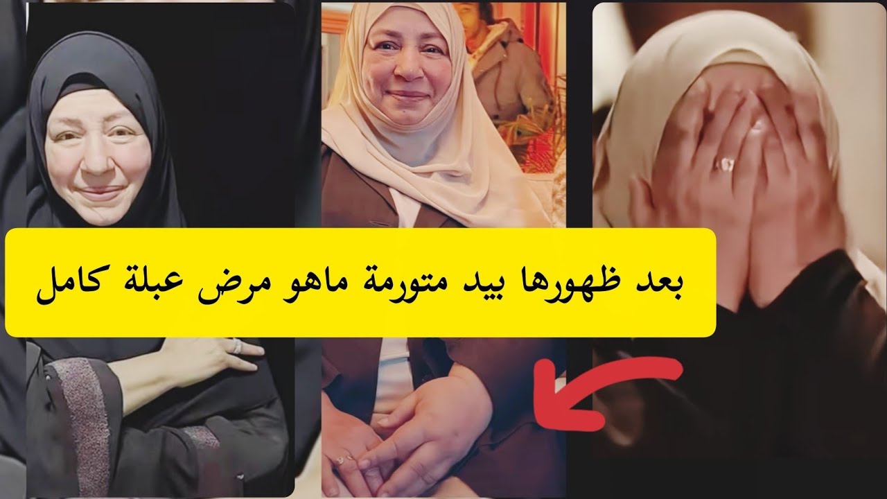 عبلة كامل ثثير مخاوف الجمهور بعد ظهورها الاخير بيد متورمة فما السبب ؟؟ #عبلة_كامل  