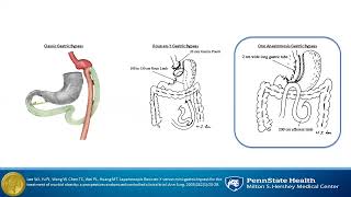 One Anastomosis Gastric Bypass/SIPS/SADI