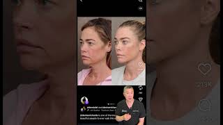 Denise Richards’ incredible face #facelift Wealth