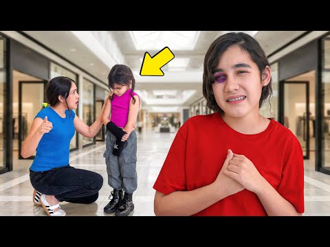 Stary Gave Her Older Sister a BLACK EYE!! (Unbelievable)