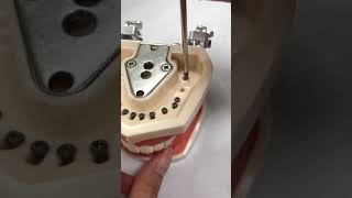 Nissin Typodont Study Cavity Preparation Training Practice Detachable Dental Implant Teeth Model screenshot 4