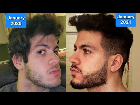 1 year patchy beard natural growth time lapse (no minoxidil)